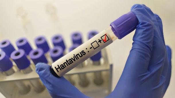 Lab technician in blue gloves holding a test tube labeled 'Hantavirus' with a red checkmark in a laboratory setting.