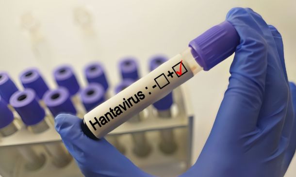 Lab technician in blue gloves holding a test tube labeled 'Hantavirus' with a red checkmark in a laboratory setting.