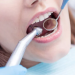 Close-up of a patient's mouth during a dental examination with a mirror and dental scaler in use.